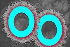 نابودی بیش از ۸۰ درصدی تومورهای تخمدان با نانوذرات جدید