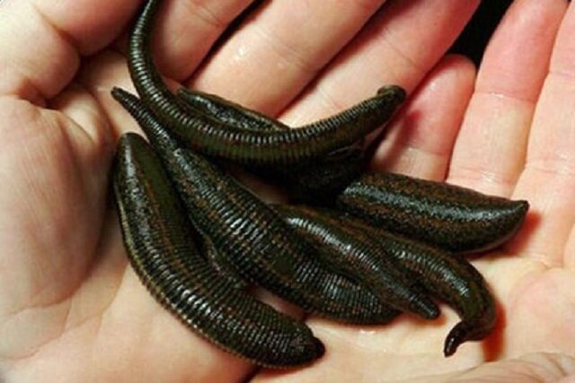 مقابله با بیماری پسوریازیس به کمک «زالو درمانی» مقابله با بیماری پسوریازیس به کمک «زالو درمانی»