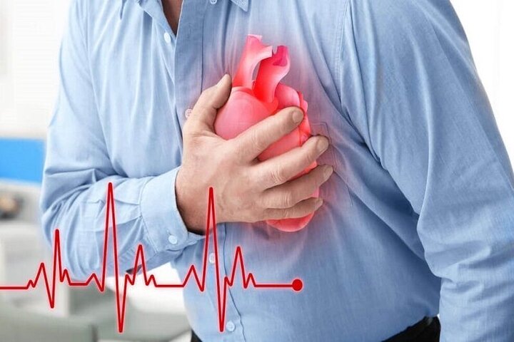 سند پیشگیری و کنترل بیماری‌های غیرواگیر در کرمانشاه تدوین شد