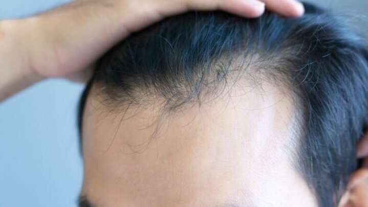 عارضه جانبی نگرانکننده داروهای لاغری که هیچکس در مورد آن صحبت نمیکند عارضه جانبی نگرانکننده داروهای لاغری که هیچکس در مورد آن صحبت نمیکند