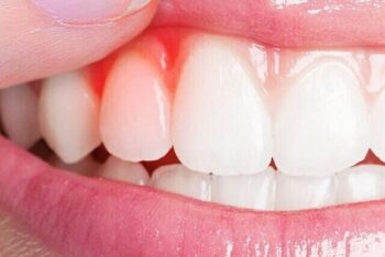 کیفیت پایین خواب، رهاورد بیماریهای لثه کیفیت پایین خواب، رهاورد بیماریهای لثه